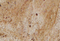 Kashmire Gold