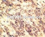 tiger skin yellow