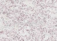 Granites Marbles Slabs Tiles Granites Marbles Slabs Tiles