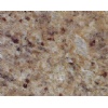 Venetian Gold granite