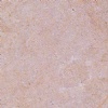Jerusalem Pink