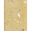 Honey Onyx Artificial Stone