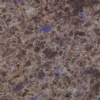 Sell Blue Eyes granite tiles
