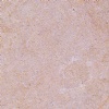 Jerusalem Pink