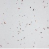 Compound stone (CH1020)