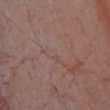 Tiles